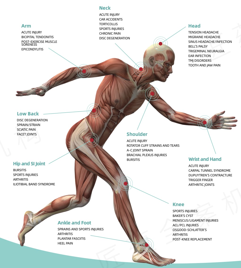 REMY FX ELITE 90W QUAD-WAVE CLASS IV THERAPY LASER SYSTEM