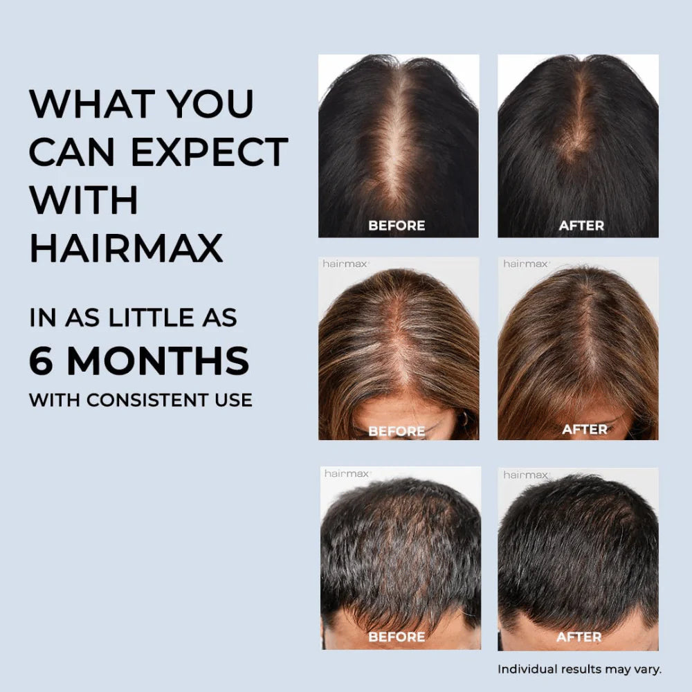 FDA-Cleared HairMax PowerFlex 272 Laser Cap – Advanced Laser Hair Growth Device for Full Scalp Coverage