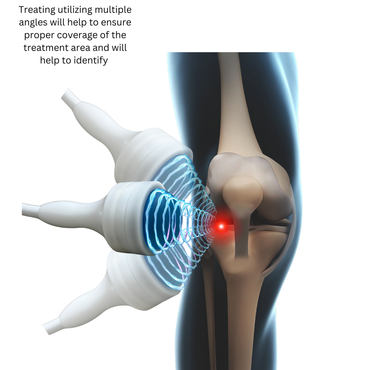 Pulse Wave™ 4th Generation Focused Shockwave Therapy Machine | FDA Registered & American-Engineered | Zero Maintenance & Fast ROI