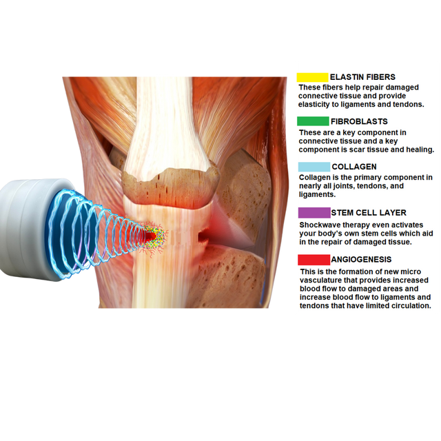 Pulse Wave™ 4th Generation Focused Shockwave Therapy Machine | FDA ...