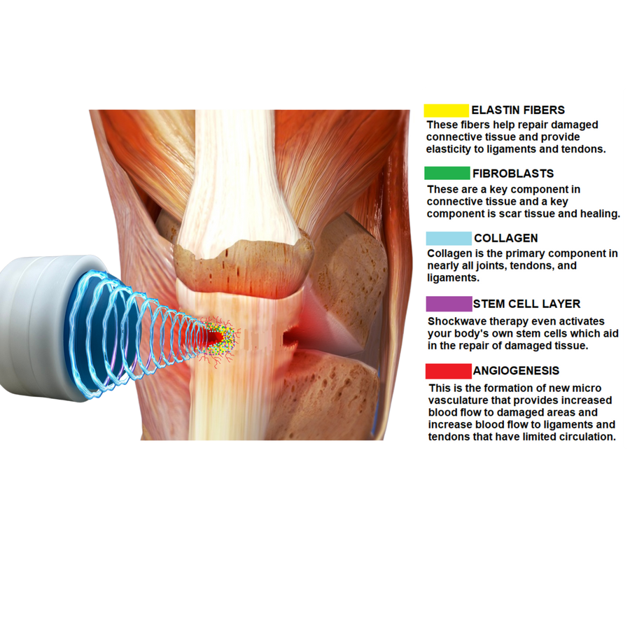 Pulse Wave™ 4th Generation Focused Shockwave Therapy Machine | FDA ...